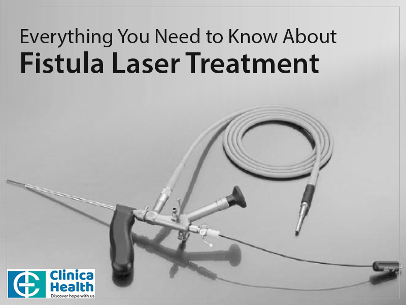 fissure laser treatment