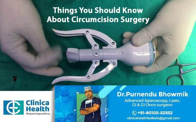 Things You Should Know About Circumcision Surgery.