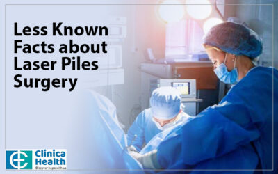 Less Known Facts about Laser Piles Surgery