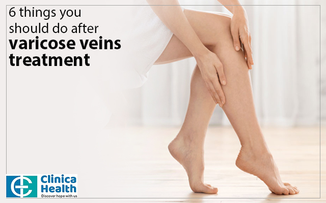 Varicose veins treatment in Kolkata